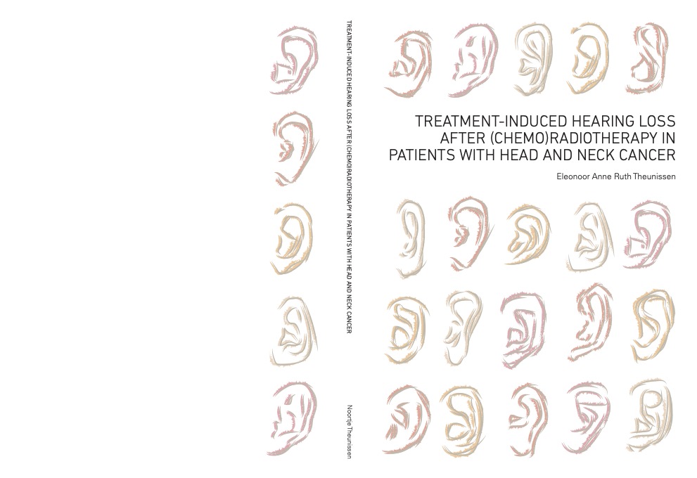 Treatment-induced hearing loss after (chemo)radiotherapy in patients with head and neck cancer