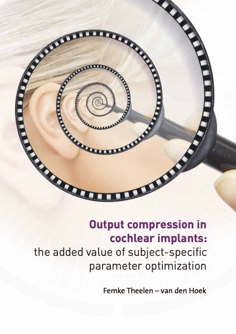 Output compression in cochlear implants: the added value of subject-specific parameter optimization