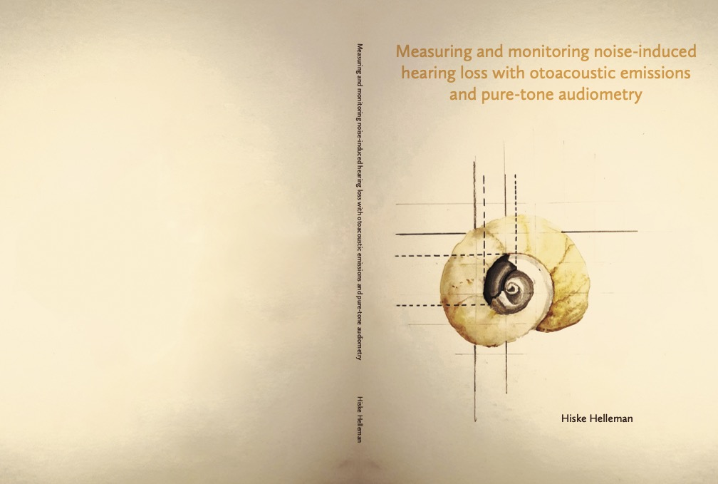 Measuring and monitoring noise-induced hearing loss with otoacoustic emissions and pure-tone audiometry